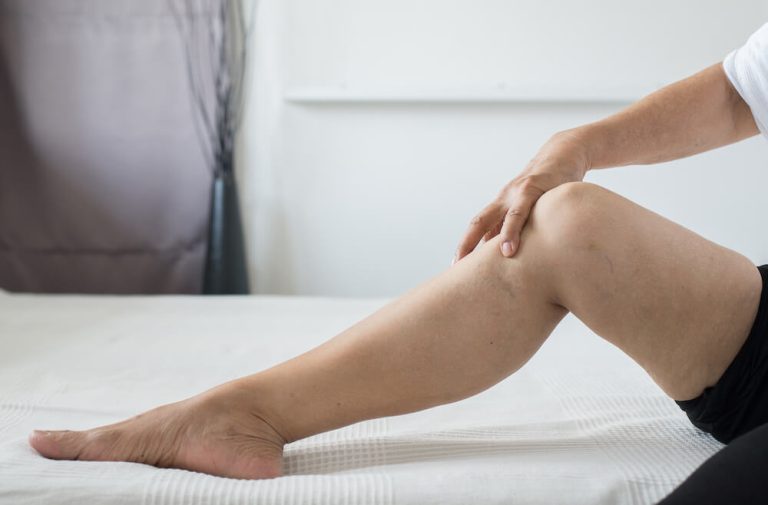 woman looking at her leg on her bed after varicose veins have re-appeared after treatment