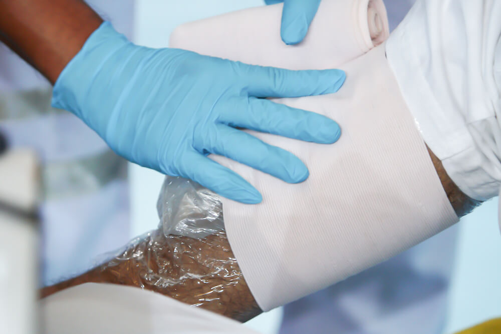 doctor applying ice after sclerotherapy