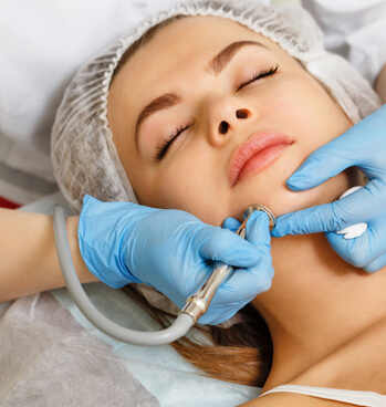 Benefits of Microdermabrasion for your skin